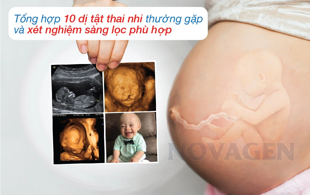 Kết quả bất thường và các biện pháp can thiệp xét nghiệm sàng lọc dị tật thai nhi: những điều mẹ bầu cần biết