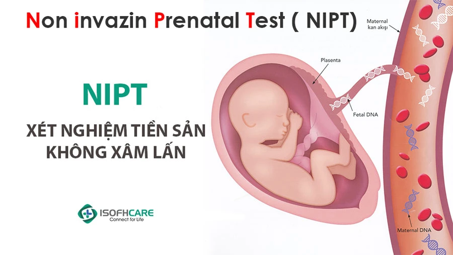 Khái niệm về xét nghiệm sàng lọc dị tật thai nhi: những điều mẹ bầu cần biết