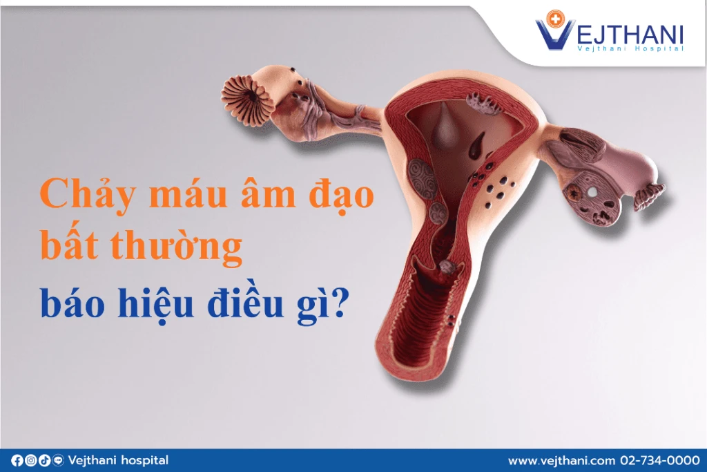 Chảy máu âm đạo bất thường triệu chứng mắc bệnh phụ khoa