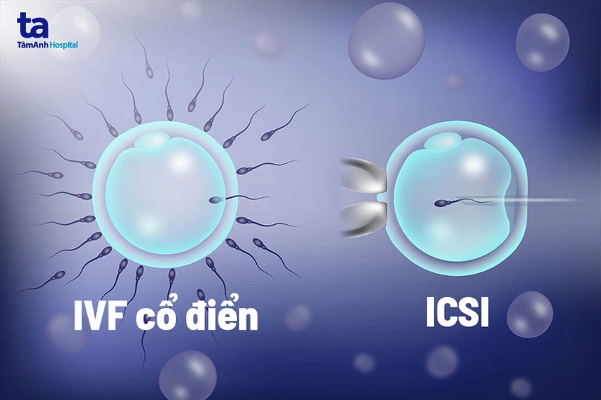 cách ai hỗ trợ trong việc chẩn đoán và đánh giá kết quả ivf/icsi hiệu của trí tuệ nhân tạo ivf icsi