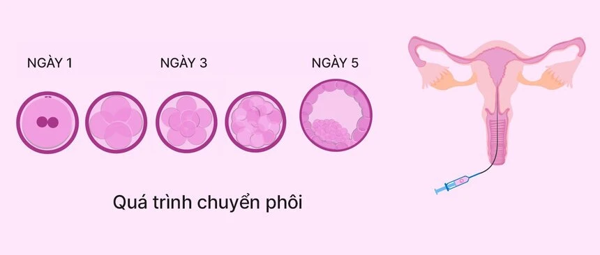 đánh giá ảnh hưởng của ai đến sự phát triển phôi hiệu quả trí tuệ nhân tạo trong ivf và icsi