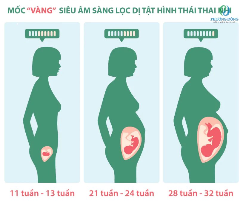 Siêu âm tuần 11-13: sàng lọc dị tật thai nhi các mốc thời gian quan trọng để thực hiện