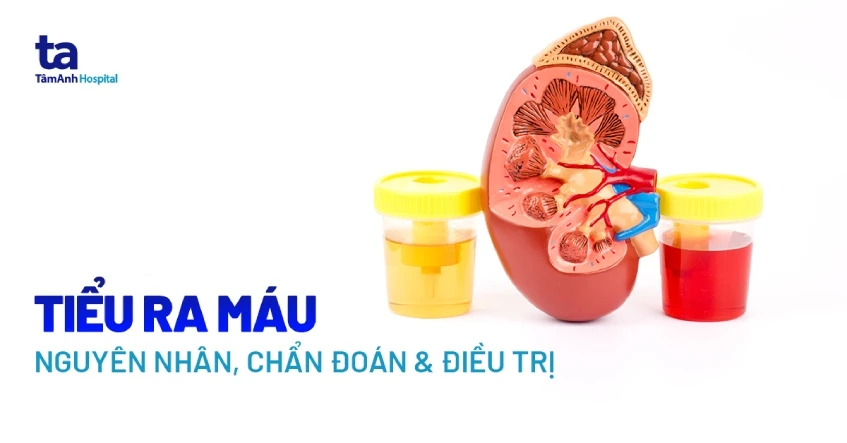 Triệu chứng nước tiểu có lẫn máu các bất thường trong thai kỳ cần đặc biệt chú ý