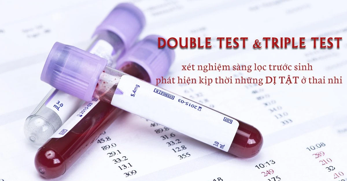 Phương pháp thực hiện xét nghiệm Triple test