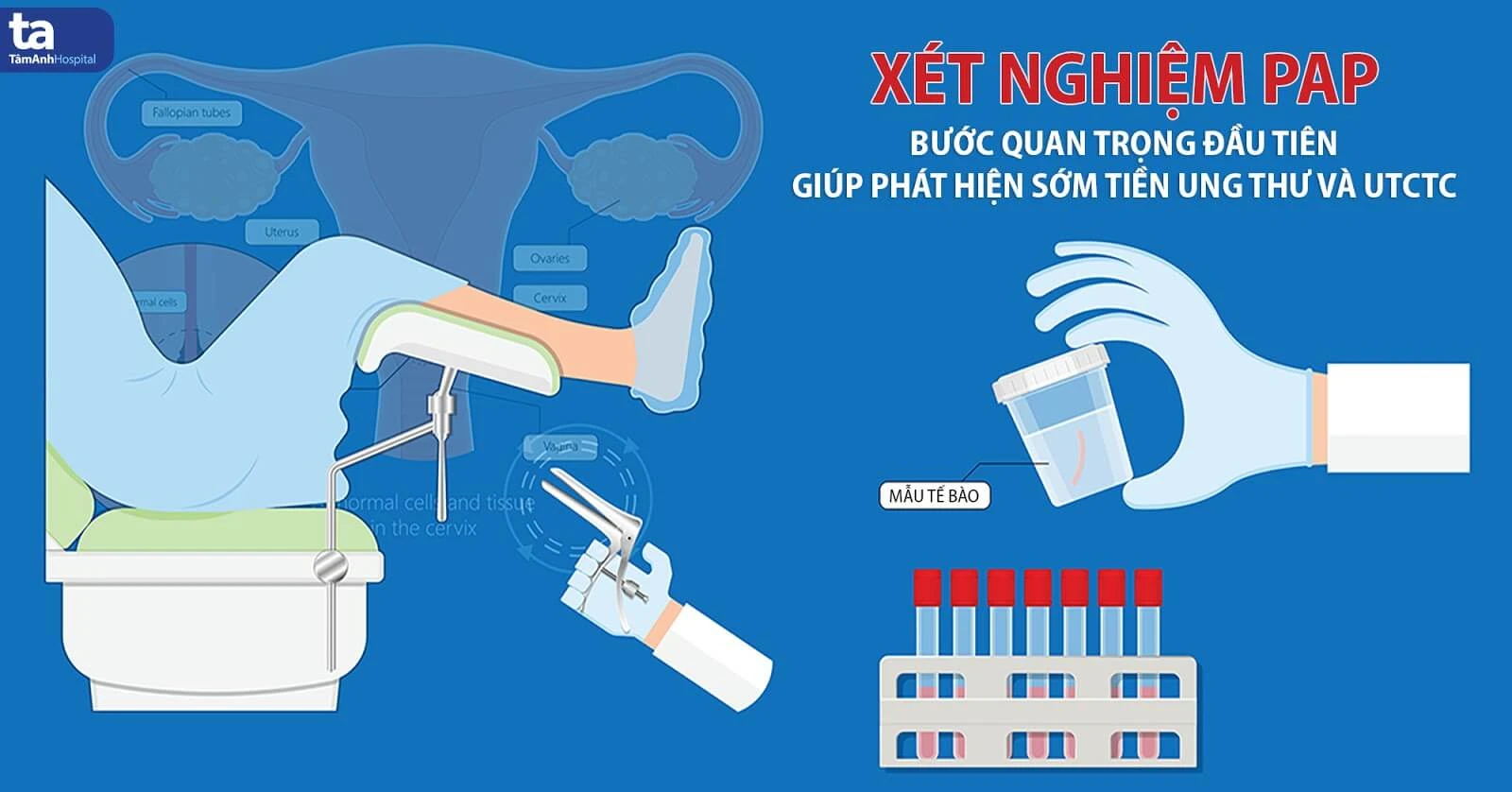 Xét nghiệm pap smear khám phụ khoa: