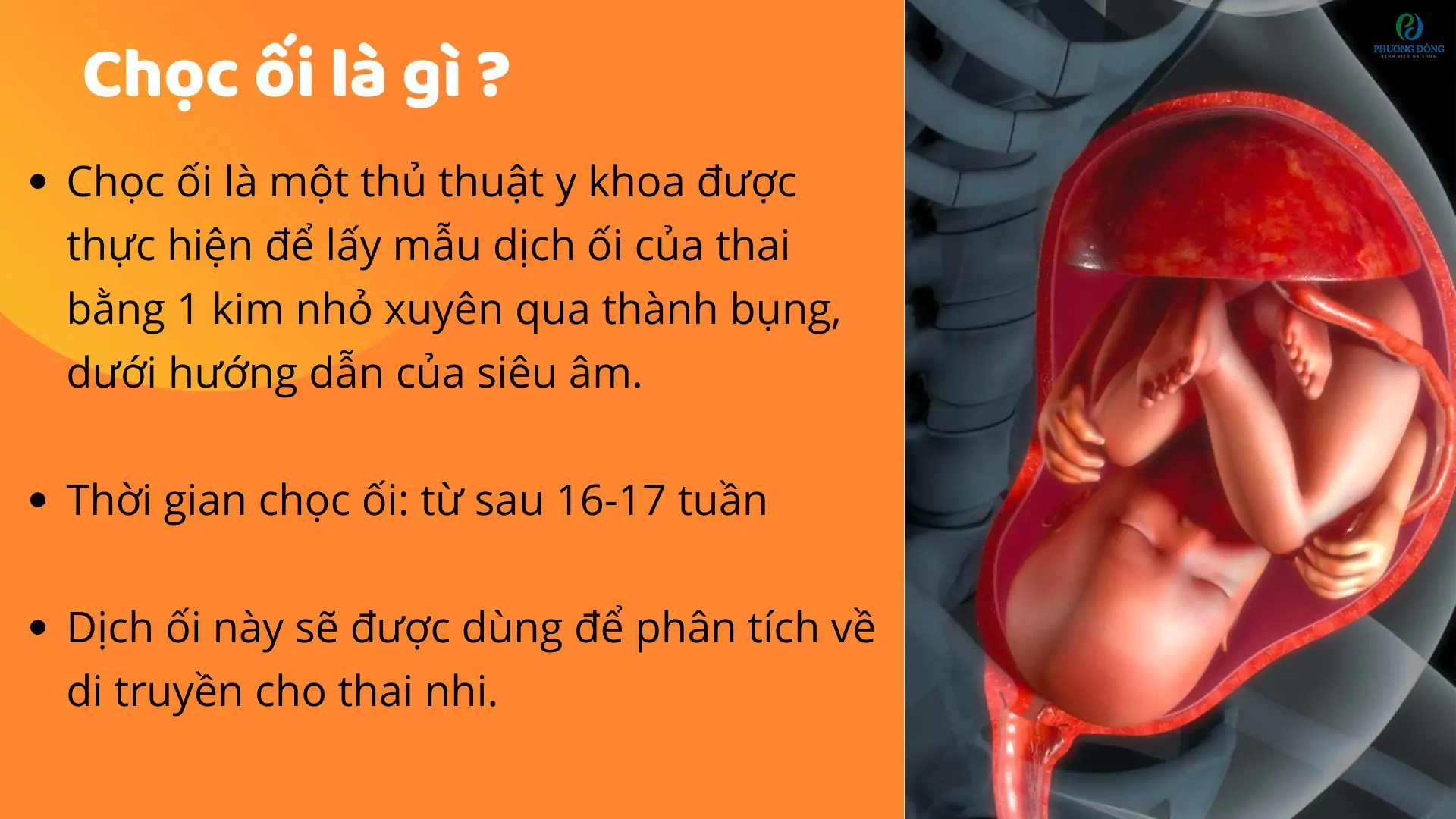 Những nguy cơ tiềm ẩn khi thực hiện chọc dò nước ối và sinh thiết nhau thai: nào cần thiết?