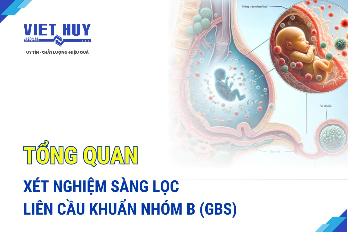 So sánh xét nghiệm gbs với các khác (liên cầu khuẩn nhóm b): tầm quan trọng và thời điểm thực hiện