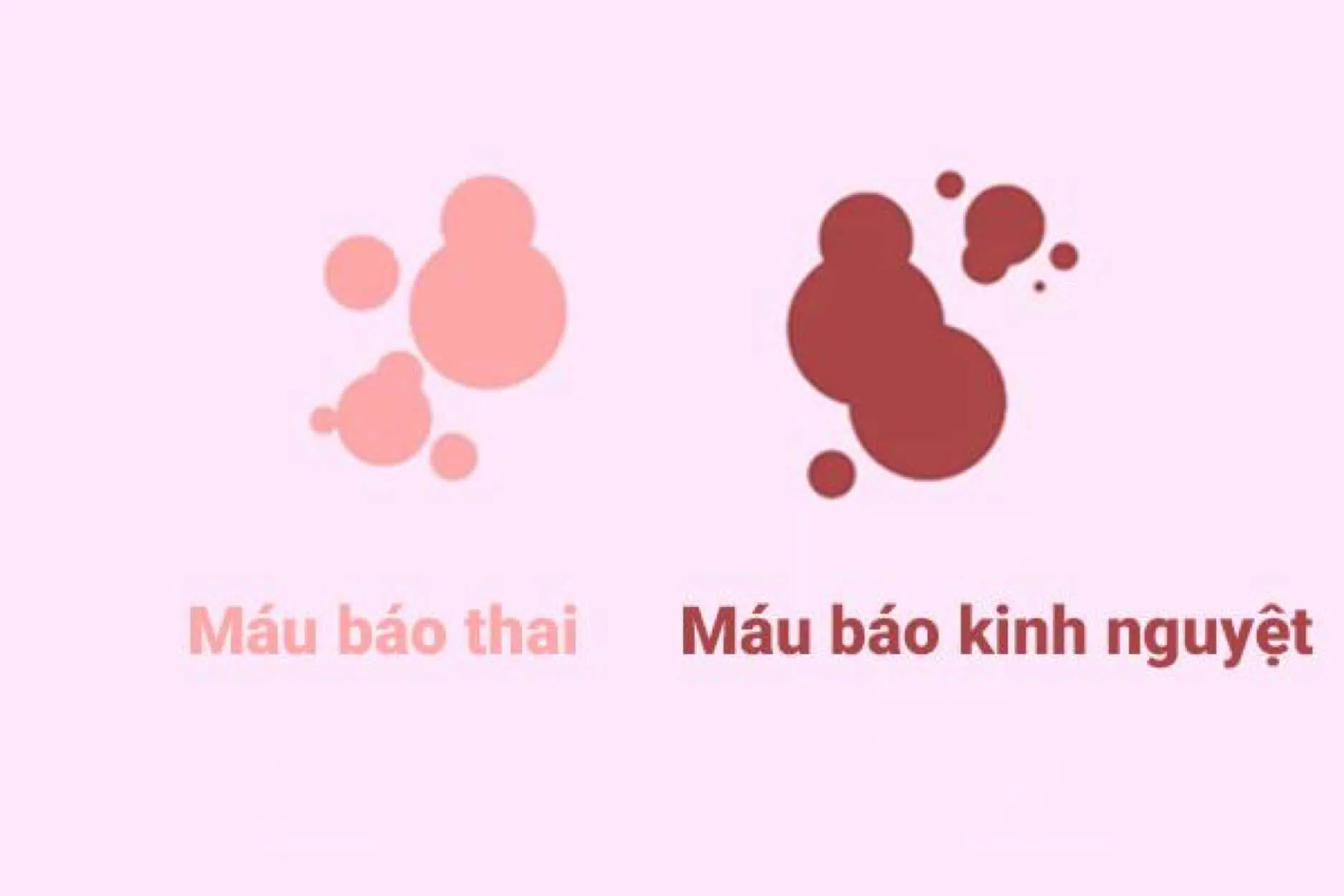 Tâm trạng thất thường 20 dấu hiệu mang thai sớm bạn cần biết