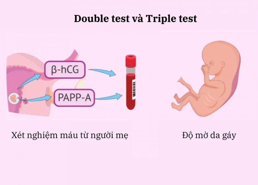 Nên làm gì sau khi có kết quả xét nghiệm Triple test