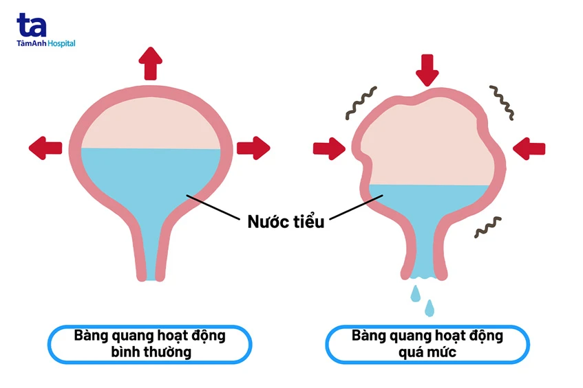 Tần suất đi tiêu giảm táo bón khi mang thai: nguyên nhân và cách phòng tránh