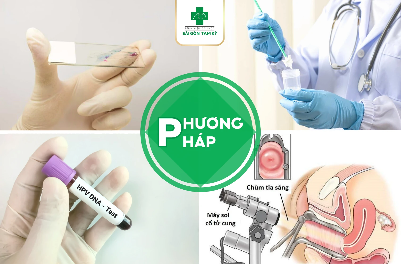 Xét nghiệm hpv khám phụ khoa: